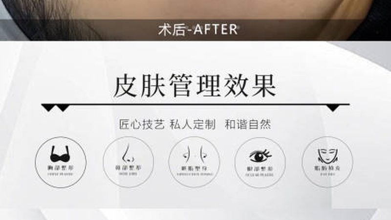 揭秘抗衰干细胞治疗：性价比背后的秘密