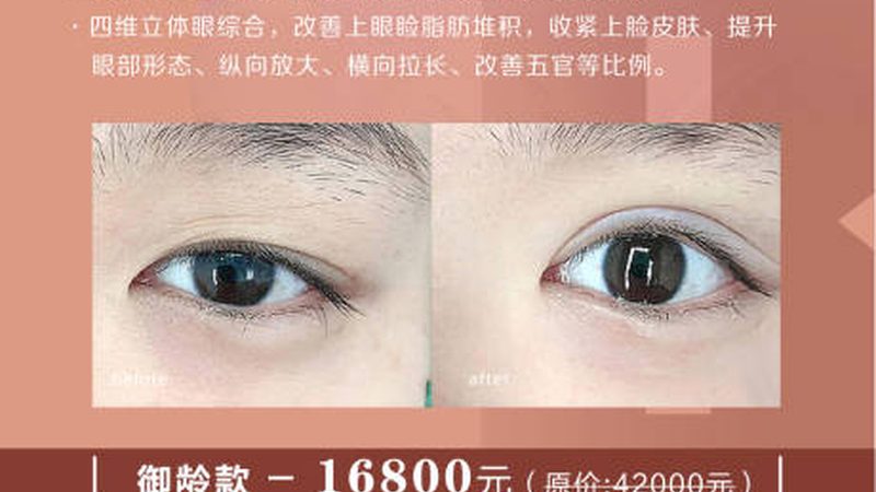 光子嫩肤后反黑？揭秘修复方法与预防技巧**