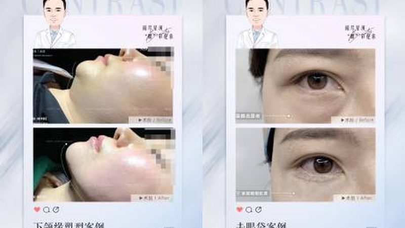 瘦脸面罩睡觉戴有没有危害