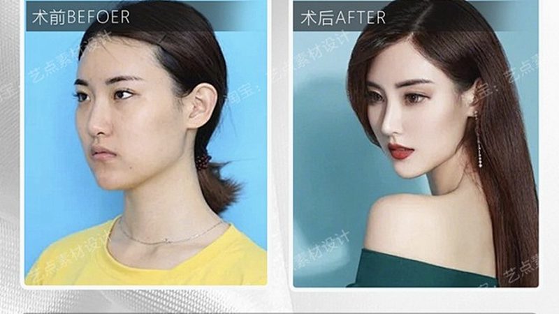 广州水光针贴牌厂家