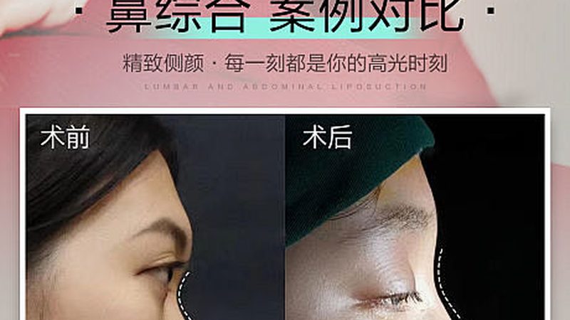 小标题：拆线后恢复速度的影响因素