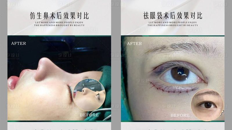 注射美容：揭秘禁忌症与适应症**