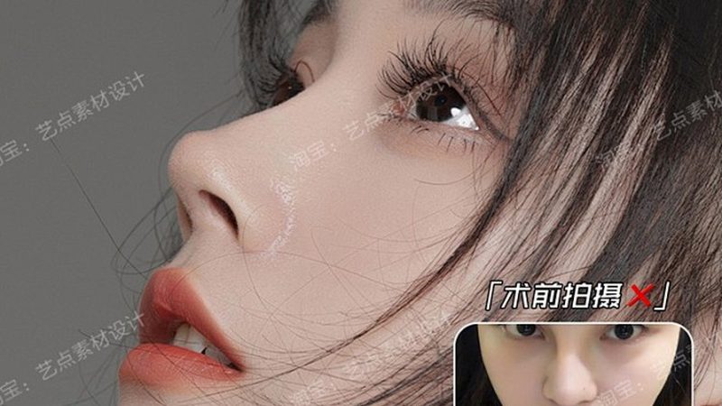 去红血丝激光治疗，费用明细全解析**