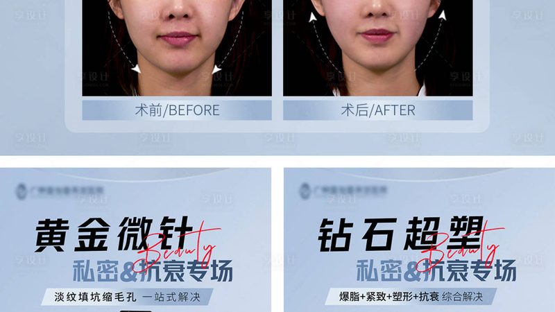 小标题：双眼皮手术，安全先行