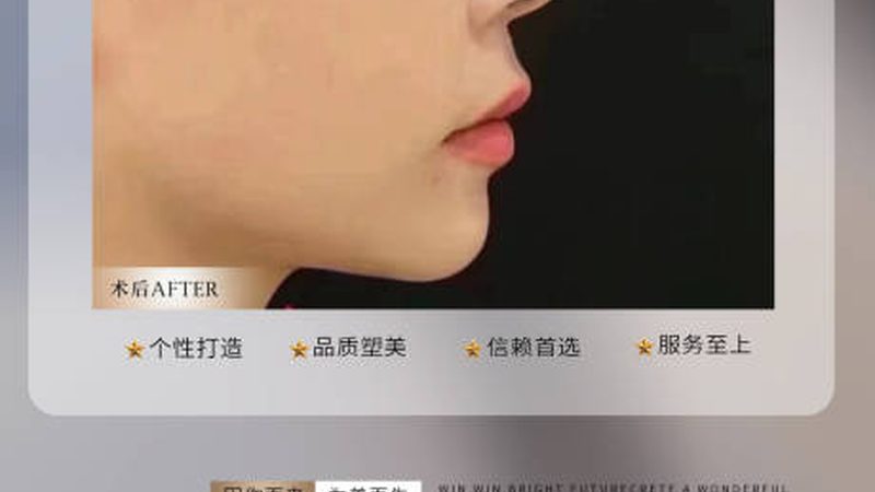 小标题：恢复期化妆的必要性