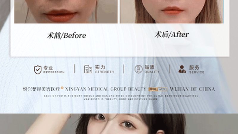 玻尿酸家族新成员：大分子与小分子定制解析**