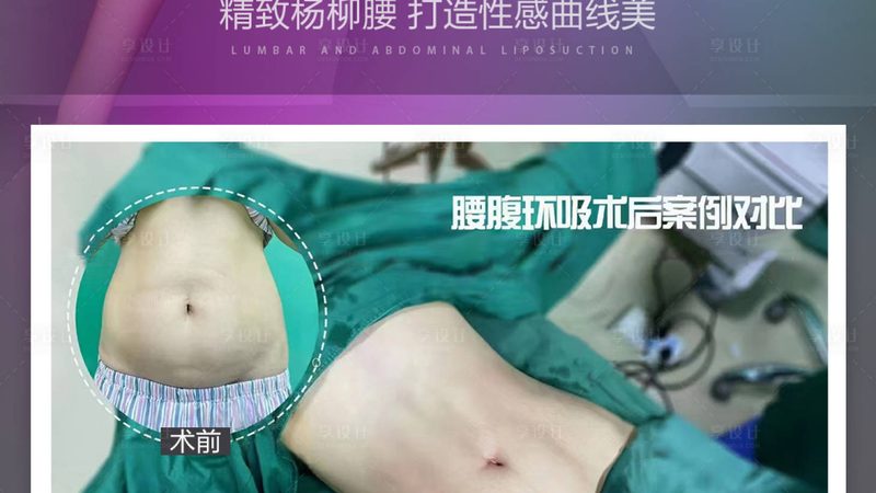 蛋白线材质标准规范
