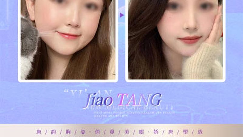 光子嫩肤美容设备加盟，揭秘费用背后的关键因素