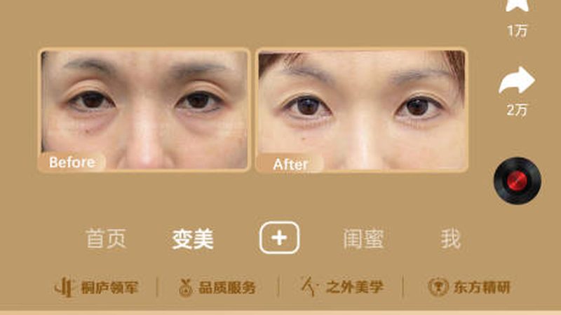 北京激光脱毛，了解这些才能告别毛毛困扰